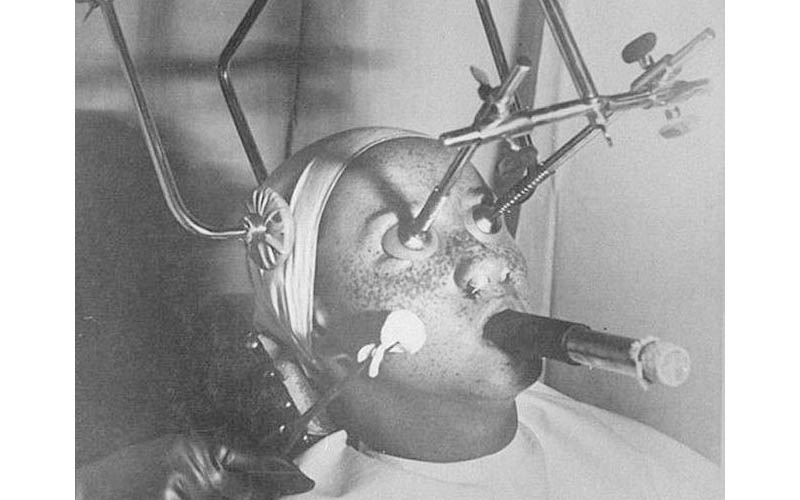 1930年的美容診所照曝光，每個儀器使用起來根本就像驚悚鬼片場景